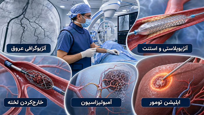 پزشکی کاربردهای رادیولوژی مداخلهای