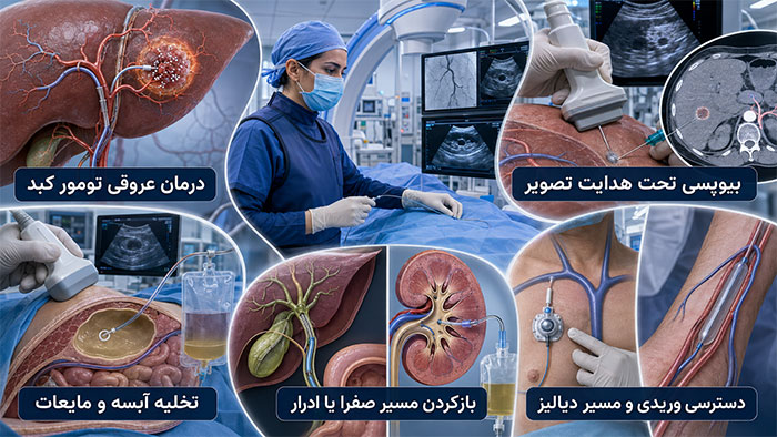 پزشکی رادیولوژی مداخله ای