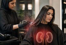 عوارض کراتین مو عوارض کراتین مو برای کلیه