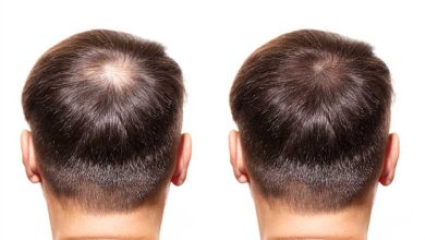 8 بهترین مواد احیای مو برای مردان (ایرانی و خارجی)