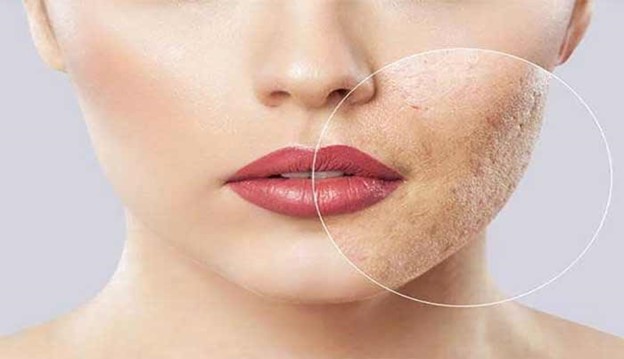 مراقبت از پوست 